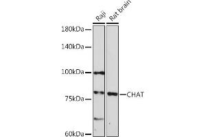 Western blot analysis of extracts of various cell lines, using CHAT Rabbit pAb (ABIN3016134, ABIN3016135, ABIN3016136 and ABIN6219569).