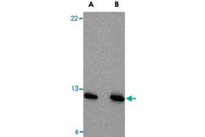 Western blot analysis of PSENEN in A-20 cell lysate with PSENEN polyclonal antibody  at (A) 0. (PEN2 抗体  (N-Term))