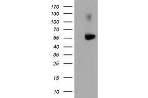 Image no. 1 for anti-Sequestosome 1 (SQSTM1) antibody (ABIN1499989) (SQSTM1 抗体)