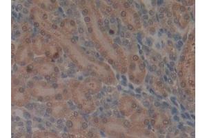 Detection of MMP3 in Rat Kidney Tissue using Monoclonal Antibody to Matrix Metalloproteinase 3 (MMP3) (MMP3 抗体  (AA 278-450))