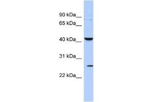 Western Blotting (WB) image for anti-Potassium Large Conductance Calcium-Activated Channel, Subfamily M, beta Member 4 (KCNMB4) (Middle Region) antibody (ABIN2776204)