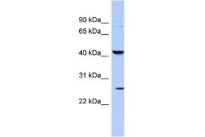 WB Suggested Anti-KCNMB4 Antibody Titration:  0. (KCNMB4 抗体  (Middle Region))