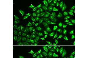 Immunofluorescence analysis of U2OS cells using MMRN1 Polyclonal Antibody (Multimerin 1 抗体)