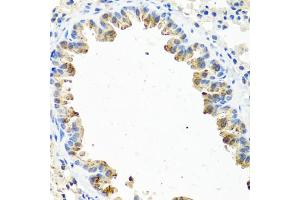 Immunohistochemistry of paraffin-embedded mouse lung using GNRH2 antibody. (GnRH2 抗体)
