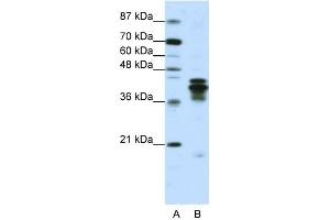 WB Suggested Anti-HNRPD Antibody Titration:  1. (HNRNPD/AUF1 抗体  (C-Term))