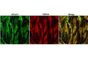 Multiplex staining of TRPV4 and KCa3.