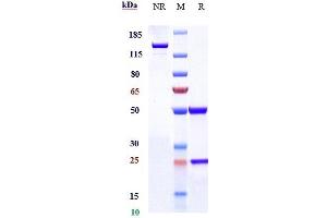 Anti-IL-5 Reference Antibody (Abgenix anti-IL-5) on SDS-PAGE under reducing (R) condition.