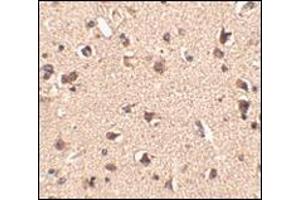 Immunohistochemistry of Slitrk6 in human brain tissue with this product at 2. (SLITRK6 抗体  (Center))