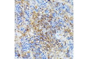 Immunohistochemistry of paraffin-embedded rat spleen using COX15 antibody (ABIN7266634) at dilution of 1:100 (40x lens). (COX15 抗体  (AA 150-250))