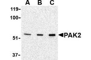 Western Blotting (WB) image for anti-P21-Activated Kinase 2 (PAK2) (N-Term) antibody (ABIN1031502)