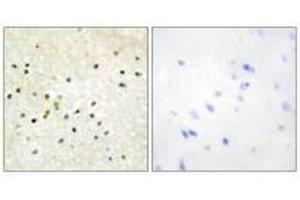Immunohistochemistry (IHC) image for anti-General Transcription Factor IIH, Polypeptide 1, 62kDa (GTF2H1) (N-Term) antibody (ABIN7184510)