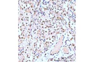 IHC analysis of Nesprin3/SYNE3 using anti-Nesprin3/SYNE3 antibody (ABIN7601328). (Nesprin3 抗体  (AA 322-495))