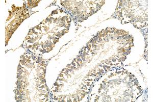 ABIN6261307 and ABIN6277247 at 1/100 staining Rat testis tissue by IHC-P. (DKK3 抗体)