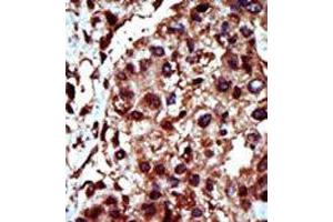 Image no. 1 for anti-Diacylglycerol Kinase, iota (DGKI) (C-Term) antibody (ABIN360602) (DGKI 抗体  (C-Term))