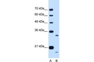 Western Blotting (WB) image for anti-Cell Cycle Progression 1 (CCPG1) antibody (ABIN2462985)