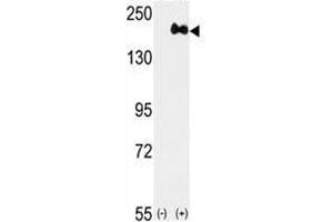 Western Blotting (WB) image for anti-Receptor tyrosine-protein kinase erbB-2 (ErbB2/Her2) (AA 1227-1255) antibody (ABIN3029510)