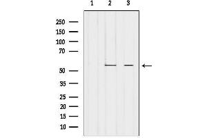 anti-Prostaglandin I2 (Prostacyclin) Synthase (PTGIS) (Internal Region) antibody