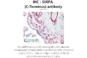 Image no. 1 for anti-Signal-Regulatory Protein alpha (SIRPA) antibody (ABIN1739273) (SIRPA 抗体)