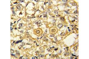 Immunohistochemistry (IHC) image for anti-Platelet Derived Growth Factor Receptor beta (PDGFRB) (AA 40-72) antibody (ABIN3029811)