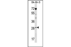 Western blot analysis in SK-BR-3 cell line lysates (35ug/lane) using STAR / STARD1 Antibody (Center) Cat. (STAR 抗体  (Middle Region))