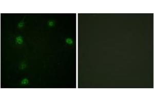 Immunofluorescence analysis of HeLa cells, using Cyclin E1 (Phospho-Thr77) Antibody. (Cyclin E1 抗体  (pThr77))