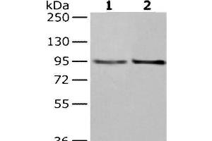 Western Blot analysis of Hela and K562 cells using NUP98 Polyclonal Antibody at dilution of 1/350 (NUP98 抗体)