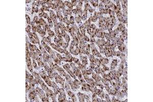 Immunohistochemical staining of human liver with MS4A13 polyclonal antibody  shows strong cytoplasmic positivity in hepatocytes at 1:10-1:20 dilution.