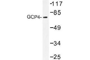 Image no. 1 for anti-Tubulin, gamma Complex Associated Protein 4 (TUBGCP4) antibody (ABIN317908) (TUBGCP4 抗体)