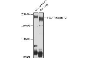Western blot analysis of extracts of various cell lines, using VEGF Receptor 2 antibody (ABIN6132247, ABIN6142816, ABIN6142819 and ABIN6215074) at 1:500 dilution. (VEGFR2/CD309 抗体  (AA 20-200))