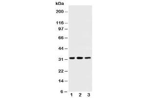 Western Blotting (WB) image for anti-Succinate Dehydrogenase Complex, Subunit B, Iron Sulfur (Ip) (SDHB) (AA 42-59) antibody (ABIN3032764)