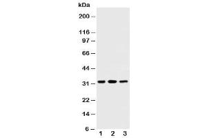 Western blot testing of SDHB antibody and Lane 1:  rat testis (SDHB 抗体  (AA 42-59))