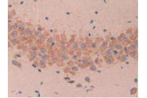 IHC-P analysis of Mouse Brain Tissue, with DAB staining. (MUC1 抗体  (AA 410-525))