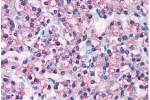 Human Parathyroid (formalin-fixed, paraffin-embedded) stained with PTH antibody ABIN305746 at 5 ug/ml followed by biotinylated anti-goat IgG secondary antibody ABIN481715, alkaline phosphatase-streptavidin and chromogen. (PTH 抗体  (AA 71-115))