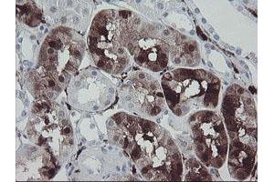 Image no. 1 for anti-Coagulation Factor XIII, A1 Polypeptide (F13A1) antibody (ABIN1498150) (F13A1 抗体)