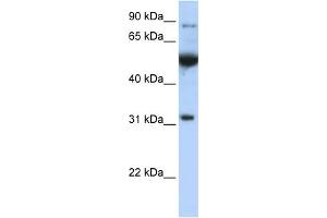 Western Blotting (WB) image for anti-Eukaryotic Translation Initiation Factor 2B, Subunit 1 Alpha, 26kDa (EIF2B1) (C-Term) antibody (ABIN2784713)