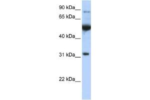 WB Suggested Anti-EIF2B1  Antibody Titration: 0. (EIF2B1 抗体  (C-Term))