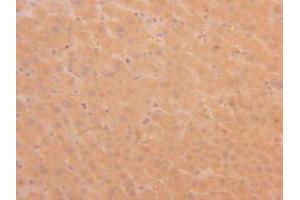 Figure. (TPSAB1 抗体  (AA 161-262))