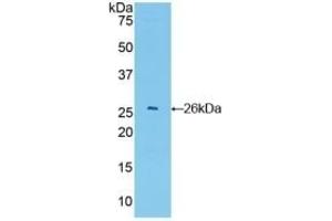 Detection of Recombinant GSTa4, Mouse using Polyclonal Antibody to Glutathione S Transferase A4 (GSTA4) (GSTA4 抗体  (AA 1-222))