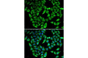 Immunofluorescence analysis of HeLa cell using ASIP antibody. (ASIP 抗体)