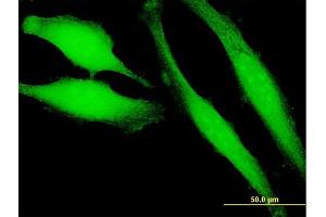 Immunofluorescence of purified MaxPab antibody to HRASLS3 on HeLa cell. (PLA2G16 抗体  (AA 1-162))