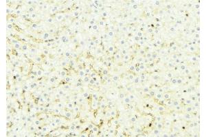 Immunohistochemistry (IHC) image for anti-Solute Carrier Family 27 (Fatty Acid Transporter), Member 5 (SLC27A5) (Internal Region) antibody (ABIN6258542)