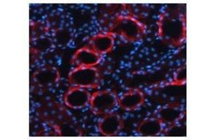 TGFB1 antibody used at a concentration of 5-10 ug/ml to detect mouse kidney (red). (TGFB1 抗体  (Middle Region))