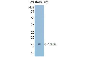 Western Blotting (WB) image for anti-Connective Tissue Growth Factor (CTGF) (AA 80-200) antibody (ABIN1858525) (CTGF 抗体  (AA 80-200))