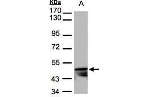 WB Image Sample(30 μg of whole cell lysate) A:HeLa S3, 7. (KRT14 抗体)