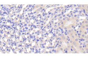 Detection of FUCa1 in Mouse Kidney Tissue using Polyclonal Antibody to Fucosidase Alpha L1, Tissue (FUCa1) (FUCA1 抗体  (AA 185-447))
