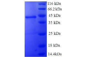 SDS-PAGE (SDS) image for Non-Metastatic Cells 1, Protein (NM23A) Expressed in (NME1) (AA 2-152) protein (GST tag) (ABIN5712257) (NME1 Protein (AA 2-152) (GST tag))