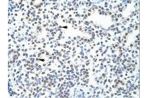 Image no. 1 for anti-Pogo Transposable Element with ZNF Domain (POGZ) (N-Term) antibody (ABIN203011) (POGZ 抗体  (N-Term))