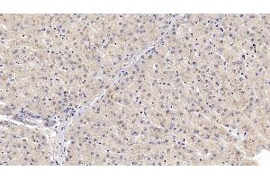 Immunohistochemistry (IHC) image for anti-Sonic Hedgehog (SHH) (AA 36-193) antibody (ABIN7426367)