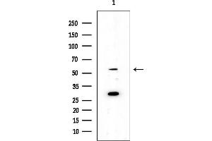anti-Golgi-Associated PDZ and Coiled-Coil Motif Containing (GOPC) (Internal Region) antibody