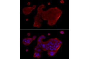 Immunoprecipitation analysis of 200 μg extracts of THP-1 cells, using 3 μg Caspase-1 antibody (ABIN3021170, ABIN3021171, ABIN3021172 and ABIN6214049). (Caspase 1 抗体  (AA 1-311))